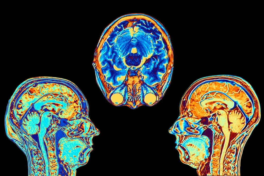 Cancer_-dr-jose-nasser-aquera-feature_3x2-1080x720